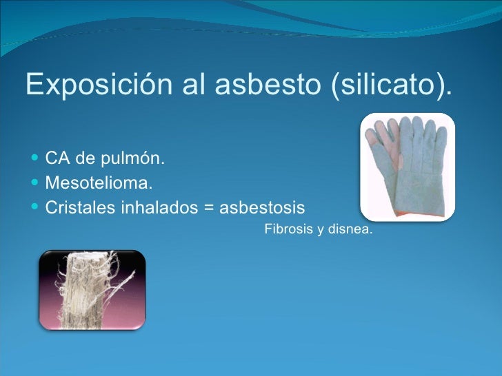 Asbesto Cancer Pulmon