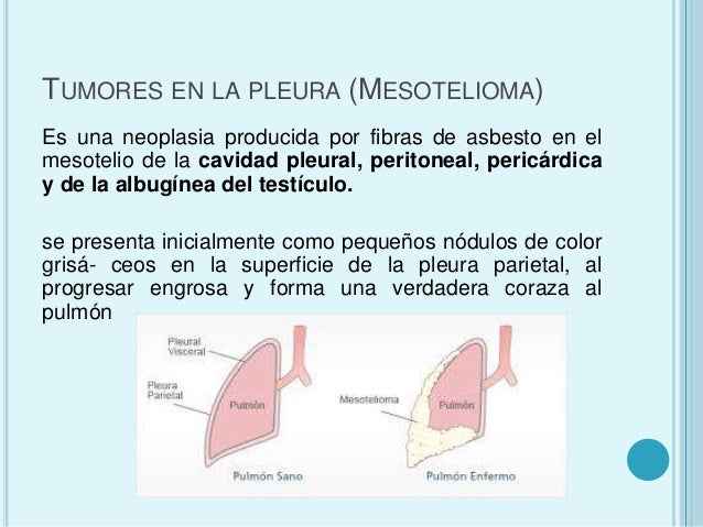 comprar tesla peru auto electrico tesla historia