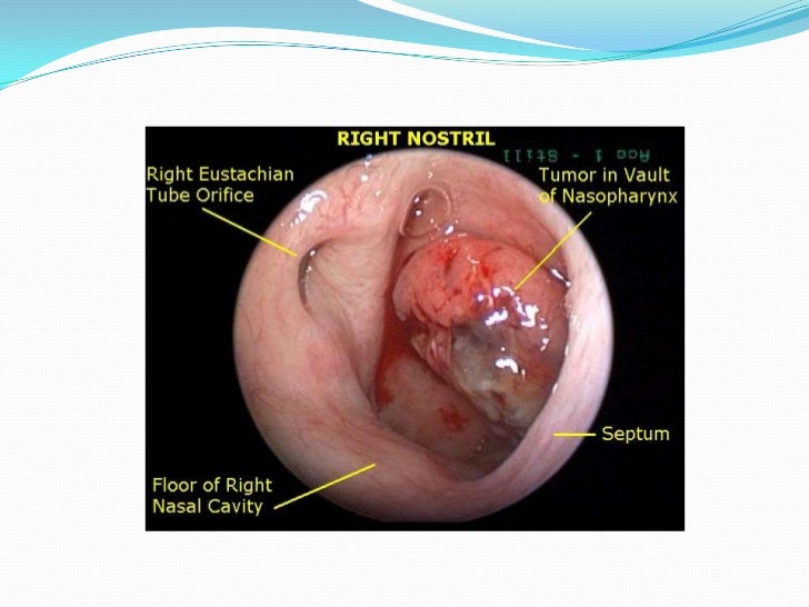 Dialysis technician annual earnings fmc dialysis van nuys
