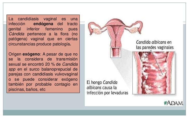 La queratosis de las uñas en los pies el tratamiento