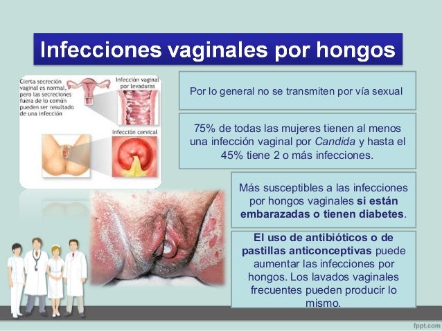 Que medicinas aceptar al hongo de las uñas de las manos