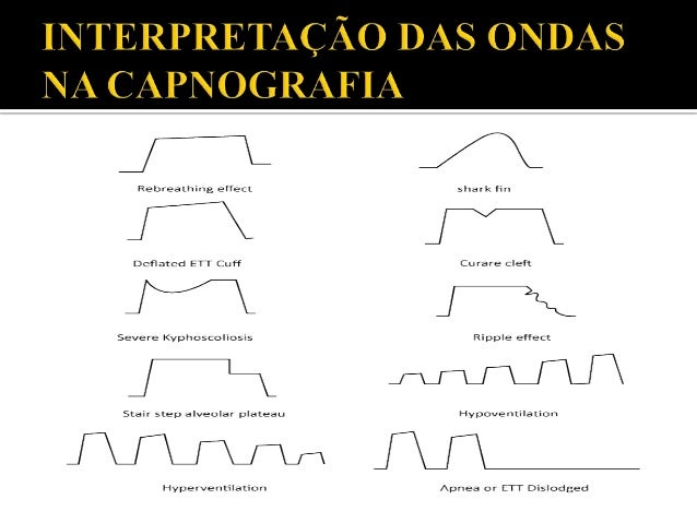 Capnografia
