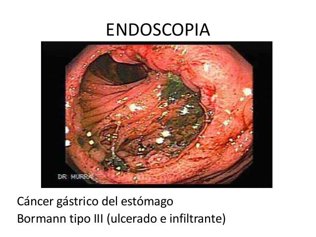 se puede adelgazar haciendo ejercicio pero sin dieta se puede adelgazar haciendo ejercicio pero sin dieta