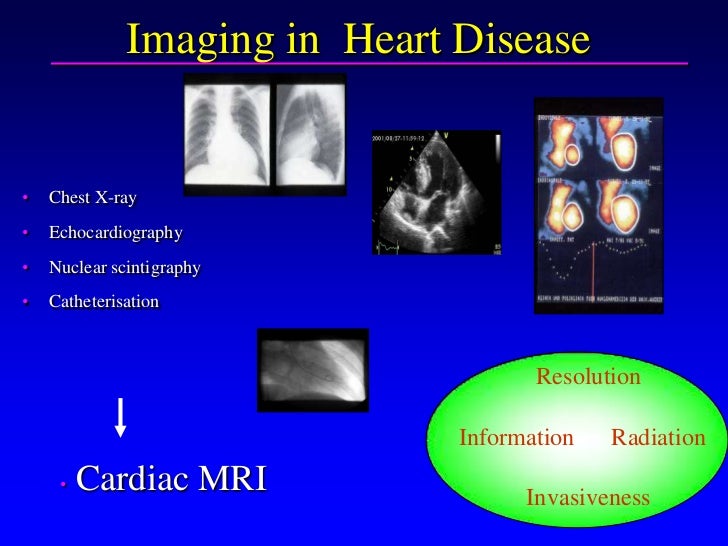 magnetic resonance imaging mri principles and applications Book description elsevier - health sciences division, united states, 2008 paperback condition: new 3rd revised edition language: english brand new book magnetic resonance imaging presents the fundamentals and principles of mri, its capabilities and various applications. magnetic resonance imaging mri principles and applications Book description elsevier - health sciences division, united states, 2008 paperback condition: new 3rd revised edition language: english brand new book magnetic resonance imaging presents the fundamentals and principles of mri, its capabilities and various applications.