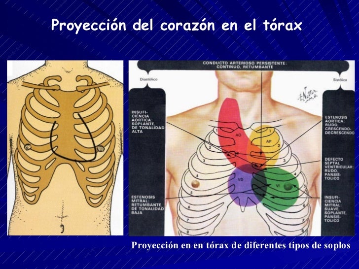 Proyeccion Del Corazon Sobre El Torax