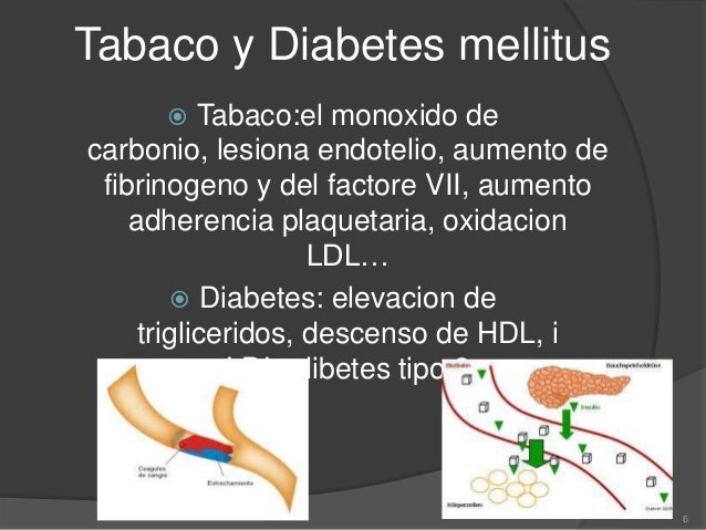 Cardiopatia isquemica Cardiopatia isquemica