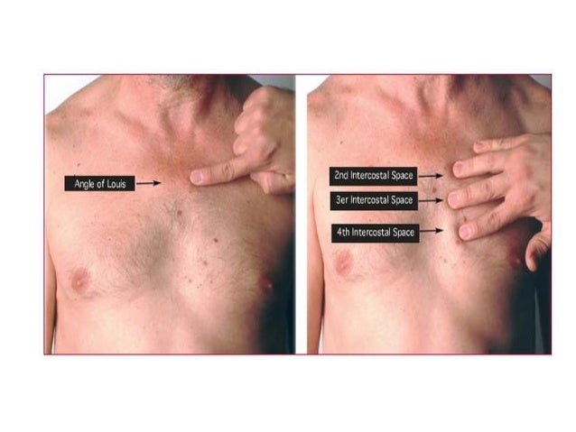Pain in the sternum to the right Pain in the sternum to the right