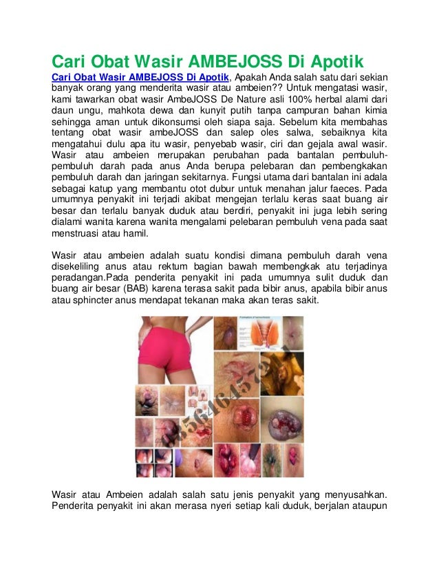 cari obat wasir ambejoss di apotik cari obat wasir ambejoss di apotik