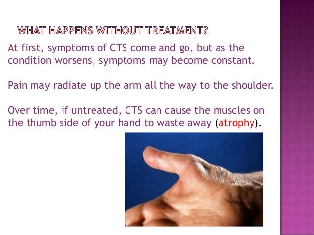 Carpal Tunnel Syndrome Case Study