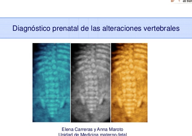 DIAGNOSTICO PRENATAL diagnostico prenatal: