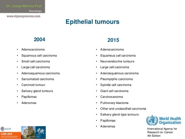 recurrent kidney most cancers analysis