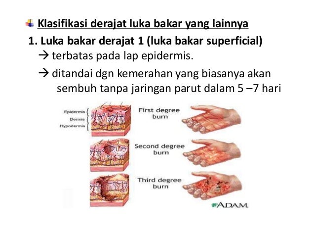 Case Report Session Skin Combustion