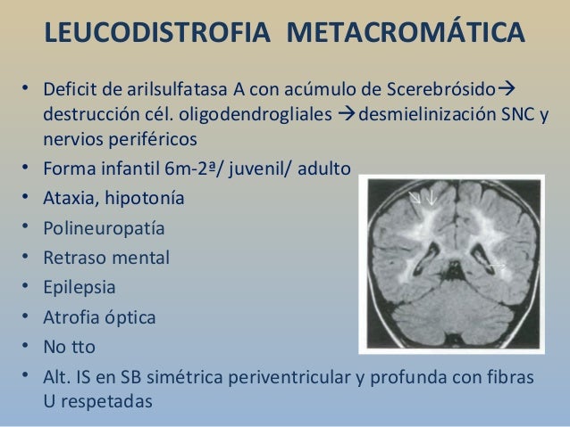 caso-cerrado-leucodistrofia-metacrom-tica