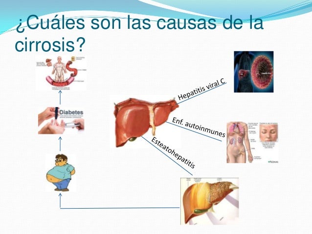 El alcoholismo el tratamiento por medio del pinchazo