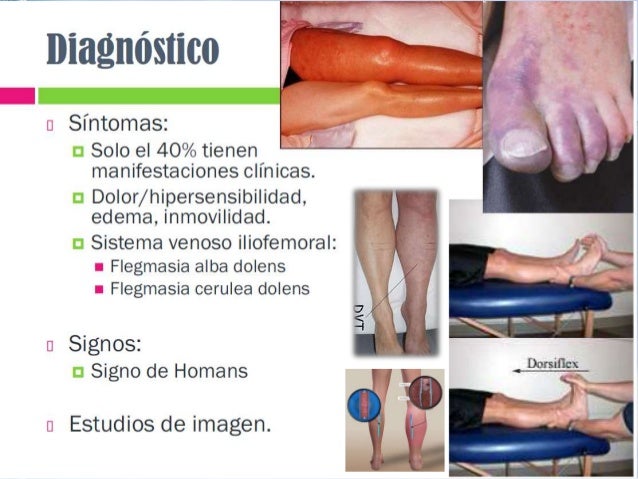 Los hinchazones de los pies de la tromboflebitis que curar