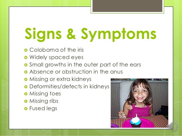 Cat Eye Syndrome