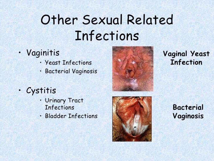 Jacksonville florida sperm bank Ass fucking sister
