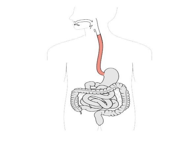 Como corregir la lordosis sheynogo del departamento de la columna vertebral