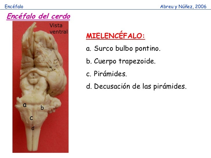 Cavidad craneana y encefalo