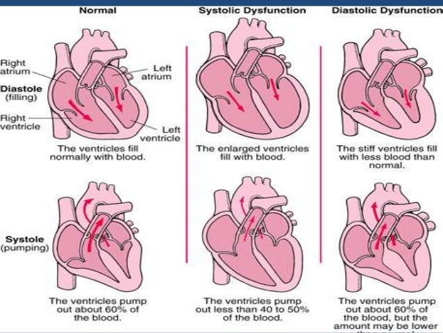 diagnosis of congestive heart failure pdf