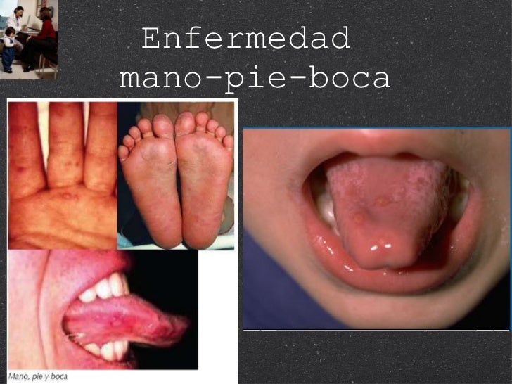 Las manchas de pigmento del uso del aceite
