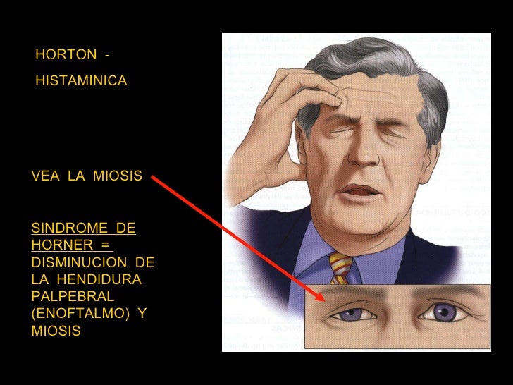 Que medicamentos del alcoholismo