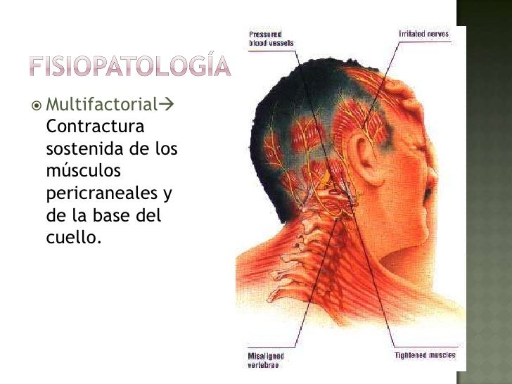 Los ejercicios a sheynogo la osteocondrosis