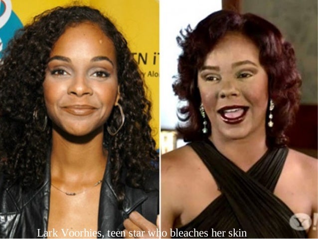 celebrity skin whitening celebrity skin whitening celebrity skin whitening celebrity skin whitening