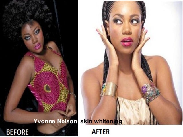 celebrity skin whitening celebrity skin whitening celebrity skin whitening celebrity skin whitening