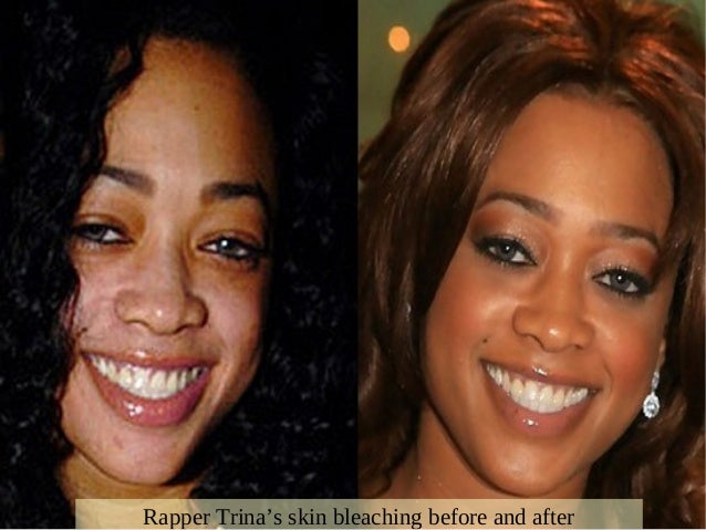 celebrity skin whitening celebrity skin whitening celebrity skin whitening celebrity skin whitening