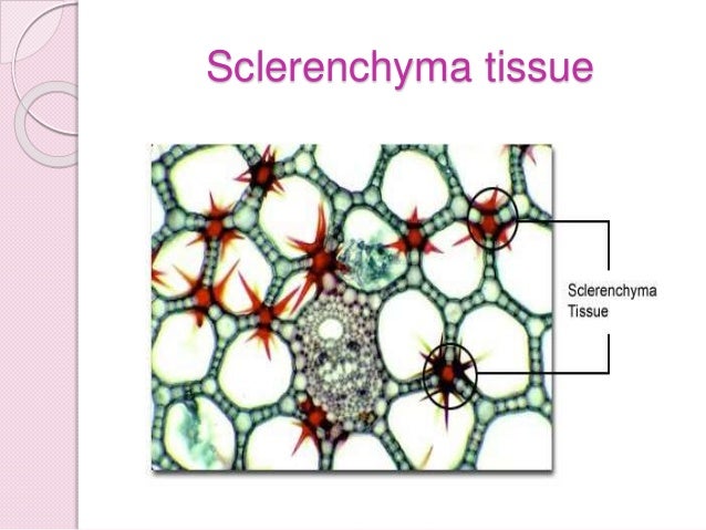 sclerenchyma tissue Biology tissues part 5 (simple permanent tissue-parenchyma,collenchyma,sclerenchyma) cbse class 9 ix - duration: 28:01 examfear education 58,857 views. sclerenchyma tissue Biology tissues part 5 (simple permanent tissue-parenchyma,collenchyma,sclerenchyma) cbse class 9 ix - duration: 28:01 examfear education 58,857 views.
