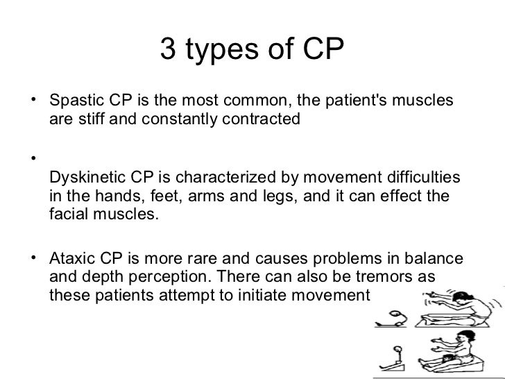 treatment for dystonic cerebral palsy