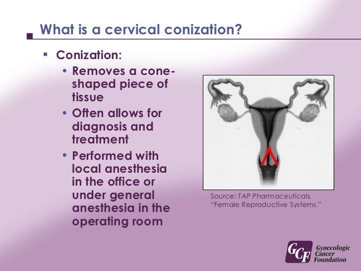 Cervical Cancer Educational Presentation