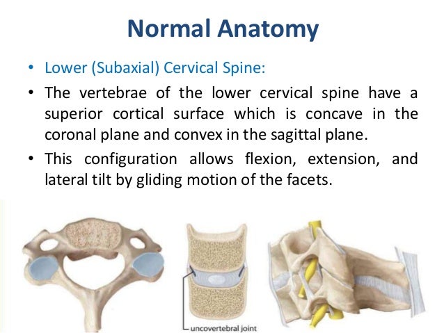 Cervical fractures