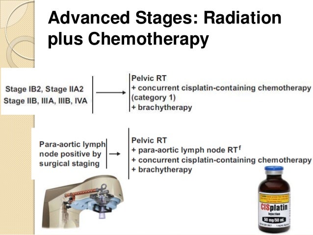 grade 2 cervical cancer survival charge