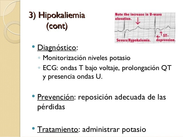 Cetoacidosis diabetica Cetoacidosis diabetica