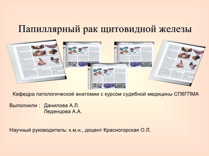 Заболевания Щитовидной Железы Презентация - taynastilya