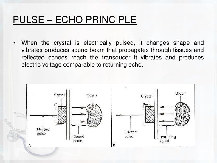 Basic physics of ultrasound.JH