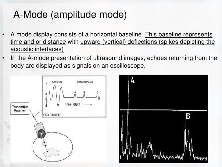 Basic physics of ultrasound.JH