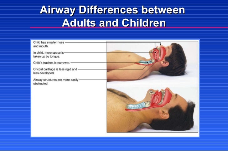 advanced airway management advanced airway management