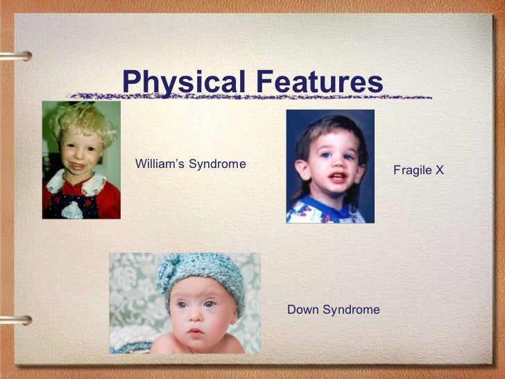 causes of physical disability pdf