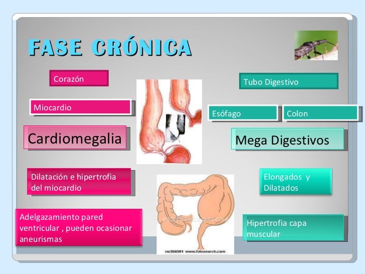 Chagas