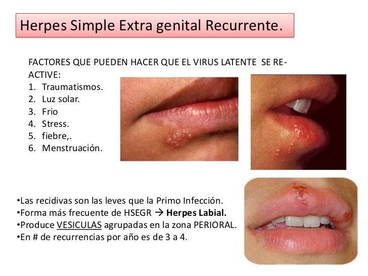 Common Symptoms of Genital Herpes in Men and Women