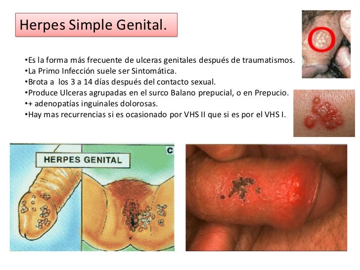 Mantu para el niño con atopicheskim por la dermatitis
