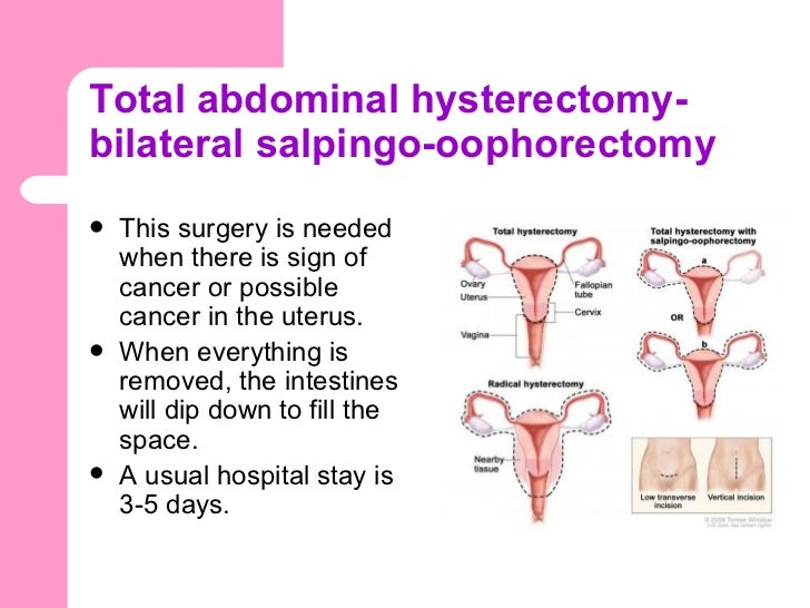 Fourth level of cervical cancer uterine most cancers early detection
