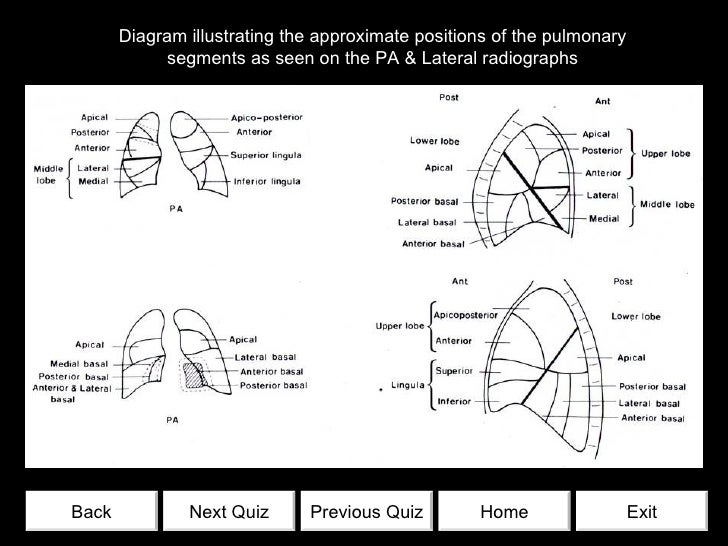 Chest radiology quiz