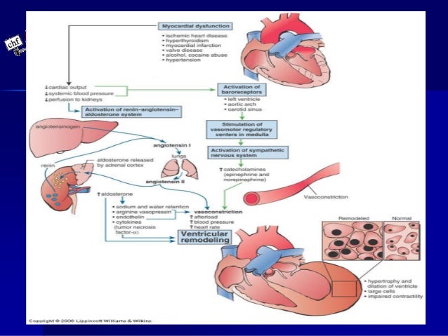 Lasix for heart failure