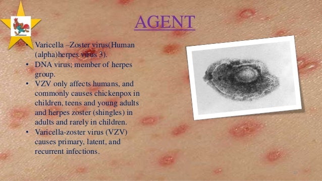 Chicken pox recurrence adults