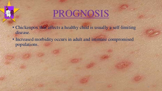 Pictures Chicken Pox Rash images on Photobucket