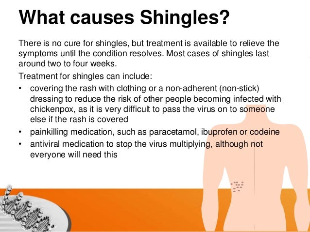 Shingles - Wikipedia